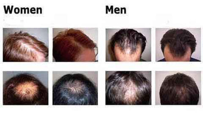 Organic Hair Growth Essence - 11 Étoiles